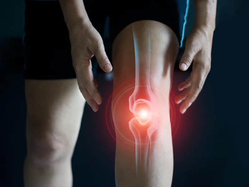 How Melbourne Chiropractic Spine & Injury Center treats arthritis in Palm Bay